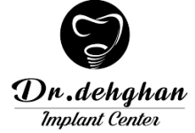 مرکز ایمپلنت دکتر دهقان