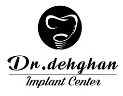 مرکز ایمپلنت دکتر دهقان